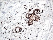 KARS Antibody - Immunohistochemical staining of paraffin-embedded Human breast tissue within the normal limits using anti-KARS mouse monoclonal antibody. (Heat-induced epitope retrieval by 1mM EDTA in 10mM Tris buffer. (pH8.5) at 120°C for 3 min. (1:500)