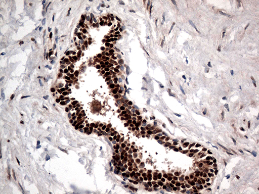 KARS Antibody - Immunohistochemical staining of paraffin-embedded Human prostate tissue within the normal limits using anti-KARS mouse monoclonal antibody. (Heat-induced epitope retrieval by 1mM EDTA in 10mM Tris buffer. (pH8.5) at 120°C for 3 min. (1:500)