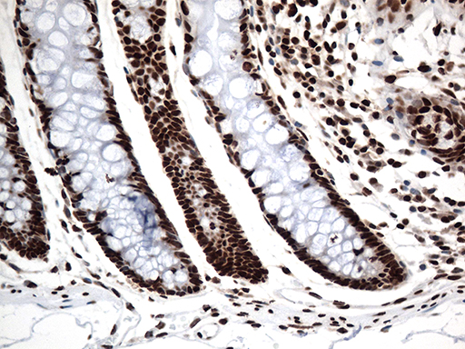 KARS Antibody - Immunohistochemical staining of paraffin-embedded Human colon tissue within the normal limits using anti-KARS mouse monoclonal antibody. (Heat-induced epitope retrieval by 1mM EDTA in 10mM Tris buffer. (pH8.5) at 120°C for 3 min. (1:500)