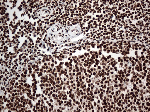 KARS Antibody - Immunohistochemical staining of paraffin-embedded Human tonsil within the normal limits using anti-KARS mouse monoclonal antibody. (Heat-induced epitope retrieval by 1mM EDTA in 10mM Tris buffer. (pH8.5) at 120°C for 3 min. (1:500)