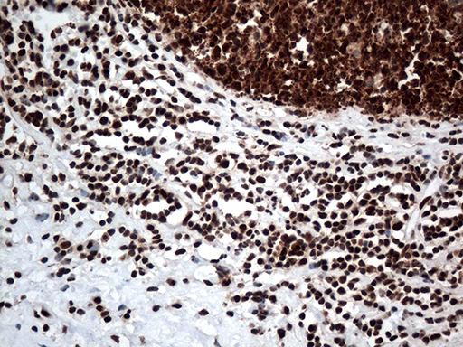 KARS Antibody - Immunohistochemical staining of paraffin-embedded Human appendix tissue within the normal limits using anti-KARS mouse monoclonal antibody. (Heat-induced epitope retrieval by 1mM EDTA in 10mM Tris buffer. (pH8.5) at 120°C for 3 min. (1:500)