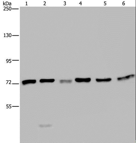 KARS Antibody - Western blot analysis of K562, A549, HT-29, 293T, HeLa and Jurkat cell, using KARS Polyclonal Antibody at dilution of 1:350.