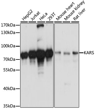 KARS Antibody - Western blot analysis of extracts of various cell lines, using KARS antibody at 1:3000 dilution. The secondary antibody used was an HRP Goat Anti-Rabbit IgG (H+L) at 1:10000 dilution. Lysates were loaded 25ug per lane and 3% nonfat dry milk in TBST was used for blocking. An ECL Kit was used for detection and the exposure time was 3s.