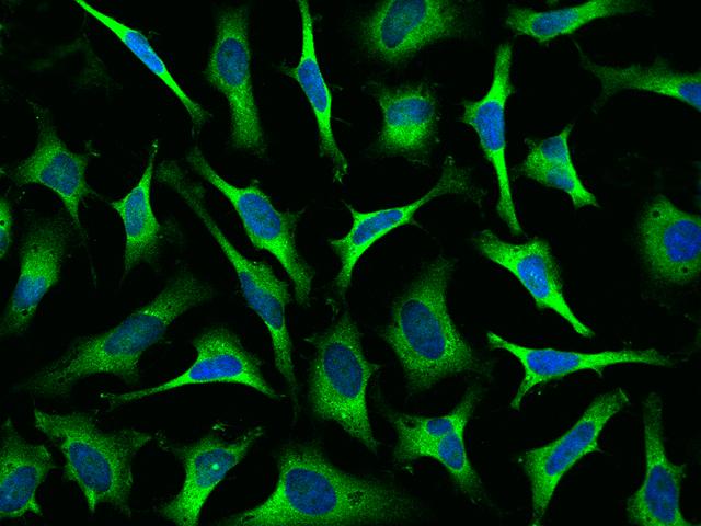 KARS Antibody - Immunofluorescence staining of KARS in HeLa cells. Cells were fixed with 4% PFA, permeabilzed with 0.1% Triton X-100 in PBS, blocked with 10% serum, and incubated with rabbit anti-Human KARS polyclonal antibody (dilution ratio 1:1000) at 4°C overnight. Then cells were stained with the Alexa Fluor 488-conjugated Goat Anti-rabbit IgG secondary antibody (green) and counterstained with DAPI (blue). Positive staining was localized to cytoplasm.