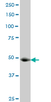 KAT2A / GCN5 Antibody - GCN5L2 monoclonal antibody (M06), clone 3F8. Western blot of GCN5L2 expression in human lung cancer.