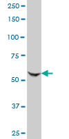 KAT2A / GCN5 Antibody - GCN5L2 monoclonal antibody (M06), clone 3F8. Western blot of GCN5L2 expression in RIN-m5F.