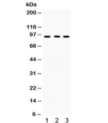 KAT2A / GCN5 Antibody