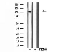 KAT2A / GCN5 Antibody - Western blot analysis of extracts of mouse brain cells using GCN5L2 antibody.