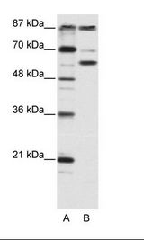 KAT2B / PCAF Antibody - A: Marker, B: HepG2 Cell Lysate.  This image was taken for the unconjugated form of this product. Other forms have not been tested.