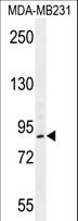 KAT2B / PCAF Antibody - PCAF Antibody western blot of MDA-MB231 cell line lysates (35 ug/lane). The PCAF antibody detected the PCAF protein (arrow).