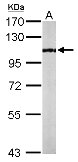 KAT2B / PCAF Antibody - Sample (50 ug of whole cell lysate). A: Mouse brain. 7.5% SDS PAGE. KAT2B / PCAF antibody diluted at 1:1000.