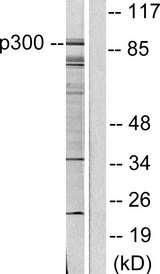 KAT2B / PCAF Antibody - Western blot analysis of lysates from COLO205 cells, using KAT2B Antibody. The lane on the right is blocked with the synthesized peptide.