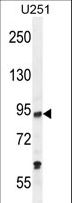 KAT2B / PCAF Antibody - PCAF Antibody western blot of U251 cell line lysates (35 ug/lane). The PCAF antibody detected the PCAF protein (arrow).