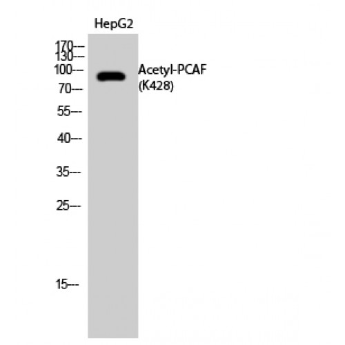 KAT2B / PCAF Antibody - Western blot of Acetyl-PCAF (K428) antibody