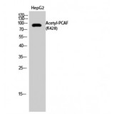 KAT2B / PCAF Antibody - Western blot of Acetyl-PCAF (K428) antibody