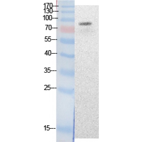 KAT2B / PCAF Antibody - Western blot of Acetyl-PCAF (K428) antibody