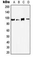 KAT2B / PCAF Antibody - Western blot analysis of PCAF expression in A431 (A); HeLa (B); HT29 (C); A549 (D) whole cell lysates.