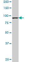 KAT2B / PCAF Antibody - PCAF monoclonal antibody (M13), clone 1E3. Western blot of PCAF expression in MES-SA/Dx5.
