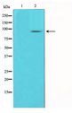 KAT2B / PCAF Antibody - Western blot of COLO205 cell lysate using PCAF Antibody