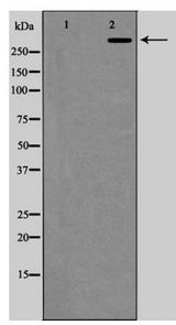 KAT2B / PCAF Antibody - Western blot of P300/CBP expression in COLO205 cells