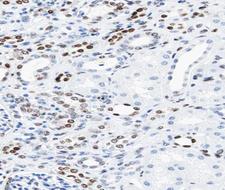 KAT2B / PCAF Antibody - 1:100 staining human kidney tissue by IHC-P. The tissue was formaldehyde fixed and a heat mediated antigen retrieval step in citrate buffer was performed. The tissue was then blocked and incubated with the antibody for 1.5 hours at 22°C. An HRP conjugated goat anti-rabbit antibody was used as the secondary.