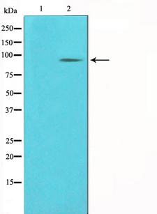 KAT2B / PCAF Antibody - Western blot analysis on COLO205 cell lysates using PCAF antibody. The lane on the left is treated with the antigen-specific peptide.