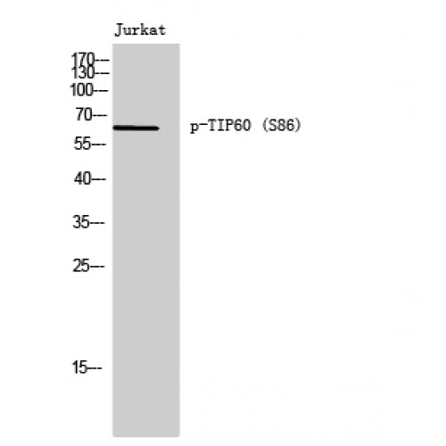 KAT5 / TIP60 Antibody - Western blot of Phospho-TIP60 (S86) antibody
