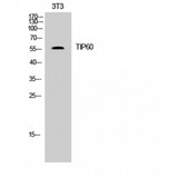 KAT5 / TIP60 Antibody - Western blot of TIP60 antibody
