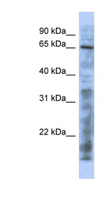 KAT5 / TIP60 Antibody - KAT5 antibody western blot of THP-1 cell lysate.  This image was taken for the unconjugated form of this product. Other forms have not been tested.