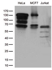 KAT5 / TIP60 Antibody - Western blot analysis of extracts. (35ug) from cell lines and/or tissue lysates by using anti-KAT5 monoclonal antibody. (1:500)