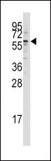 KAT5 / TIP60 Antibody - Western blot of anti-HTATIP antibody in Jurkat cell line lysates (35 ug/lane). HTATIP(arrow) was detected using the purified antibody.