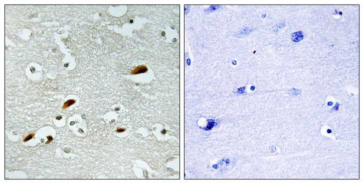 KAT5 / TIP60 Antibody - Immunohistochemistry analysis of paraffin-embedded human brain tissue, using TIP60 Antibody. The picture on the right is blocked with the synthesized peptide.