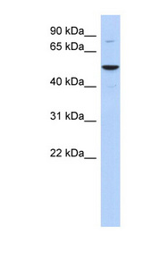 KAT5 / TIP60 Antibody - KAT5 antibody Western blot of COLO205 cell lysate. This image was taken for the unconjugated form of this product. Other forms have not been tested.