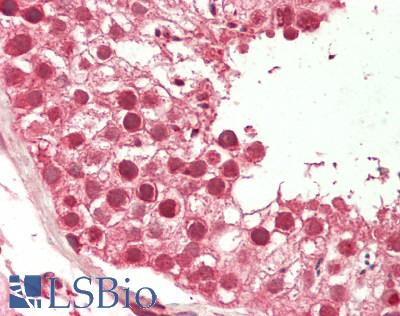 KAT5 / TIP60 Antibody - Human Testis: Formalin-Fixed, Paraffin-Embedded (FFPE)