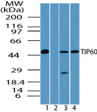 KAT5 / TIP60 Antibody - Western blot of TIP60 in human brain lysate in the 1) absence and 2) presence of immunizing peptide, 3) mouse brain and 4) rat brain lysate using Polyclonal Antibody to TIP60 at 0.25 ug/ml.