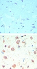 KAT5 / TIP60 Antibody - IHC ofTIP60 in formalin-fixed, paraffin-embedded human brain tissue using an isotype control (top) and Polyclonal Antibody to TIP60 (bottom) at5 ug/ml.