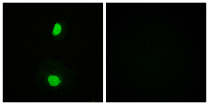 KAT5 / TIP60 Antibody - Immunofluorescence analysis of HeLa cells, using TIP60 Antibody. The picture on the right is blocked with the synthesized peptide.