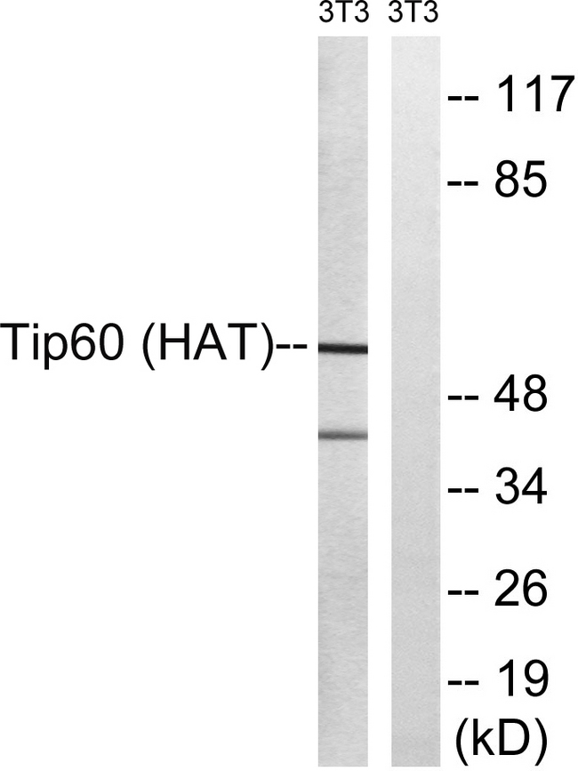 KAT5 / TIP60 Antibody - Western blot analysis of lysates from NIH/3T3 cells, treated with starved 24h, using Tip60 Antibody. The lane on the right is blocked with the synthesized peptide.