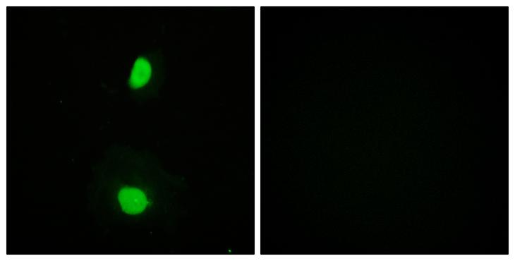 KAT5 / TIP60 Antibody - Peptide - + Immunofluorescence analysis of HeLa cells, using TIP60 antibody.