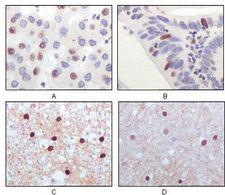 KAT5 / TIP60 Antibody - TIP60 Antibody in Immunohistochemistry (IHC)