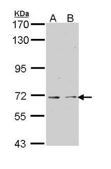 KAT5 / TIP60 Antibody - Sample (30 ug of whole cell lysate). A: 293T. B: A431. 7.5% SDS PAGE. KAT5 antibody diluted at 1:1000. 