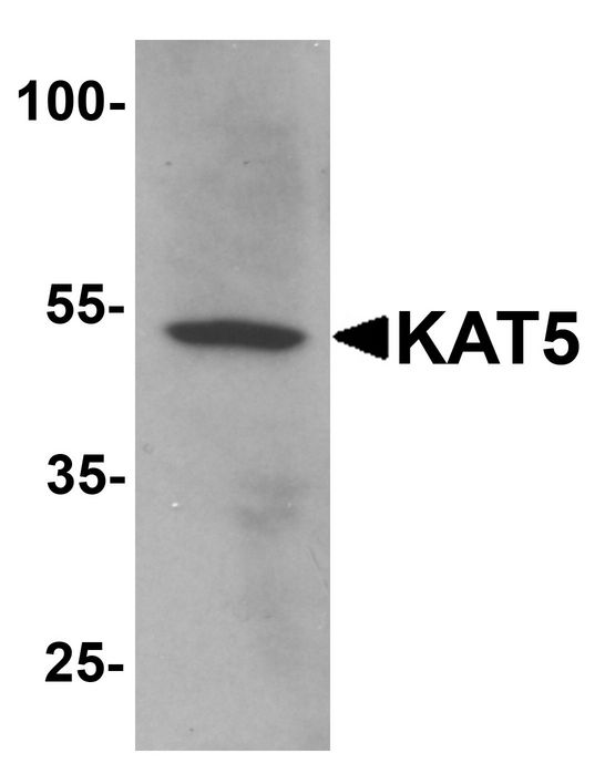 KAT5 / TIP60 Antibody - Western blot analysis of KAT5 in human brain tissue lysate with KAT5 antibody at 1 ug/ml.