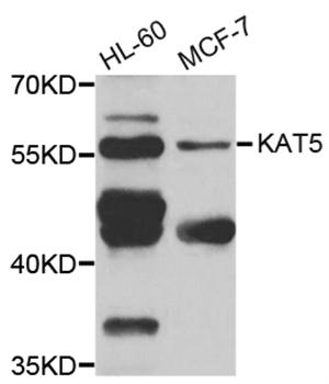 KAT5 / TIP60 Antibody - Western blot analysis of extracts of HeLa cells.