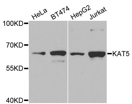 KAT5 / TIP60 Antibody - Western blot analysis of extracts of various cell lines, using KAT5 antibody at 1:1000 dilution. The secondary antibody used was an HRP Goat Anti-Rabbit IgG (H+L) at 1:10000 dilution. Lysates were loaded 25ug per lane and 3% nonfat dry milk in TBST was used for blocking. An ECL Kit was used for detection and the exposure time was 90s.