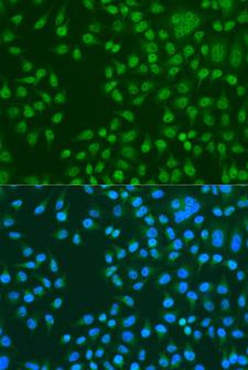 KAT5 / TIP60 Antibody - Immunofluorescence analysis of U2OS cells using KAT5 antibodyat dilution of 1:100. Blue: DAPI for nuclear staining