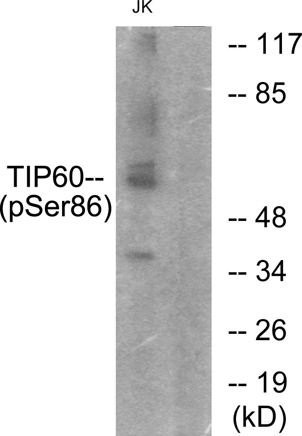 KAT5 / TIP60 Antibody - Western blot analysis of lysates from Jurkat cells, using TIP60 (Phospho-Ser86) Antibody. The lane on the right is blocked with the phospho peptide.