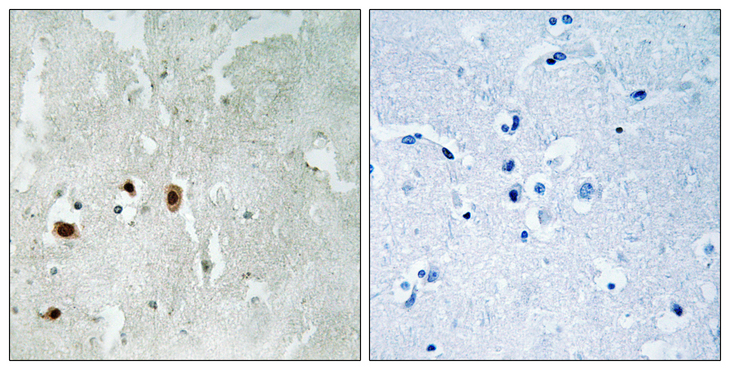KAT5 / TIP60 Antibody - Immunohistochemistry analysis of paraffin-embedded human brain, using Tip60 (Phospho-Ser90) Antibody. The picture on the right is blocked with the phospho peptide.