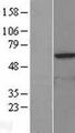 KAT5 / TIP60 Protein - Western validation with an anti-DDK antibody * L: Control HEK293 lysate R: Over-expression lysate