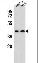 KATII / AADAT Antibody - AADAT Antibody western blot of HepG2,Y79 cell line lysates (35 ug/lane). The AADAT antibody detected the AADAT protein (arrow).