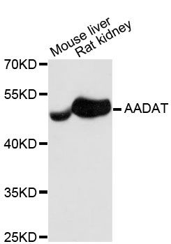 KATII / AADAT Antibody - Western blot analysis of extracts of various cell lines, using AADAT antibody at 1:3000 dilution. The secondary antibody used was an HRP Goat Anti-Rabbit IgG (H+L) at 1:10000 dilution. Lysates were loaded 25ug per lane and 3% nonfat dry milk in TBST was used for blocking. An ECL Kit was used for detection and the exposure time was 90s.